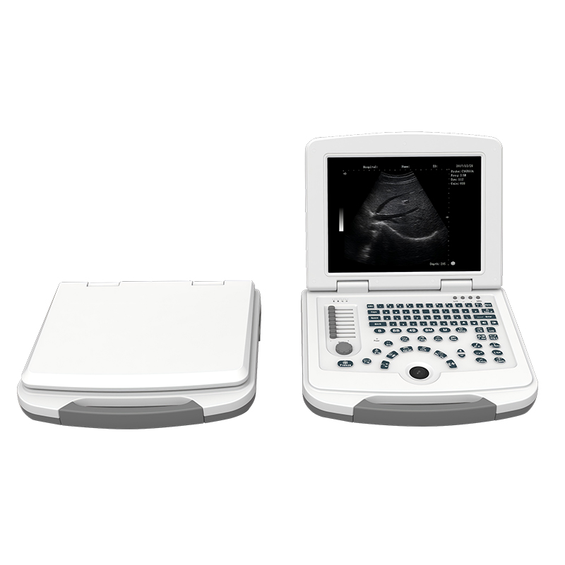 Ultrasound System RAD-US03